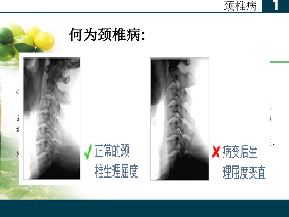 办公室常见病与健康_第4页