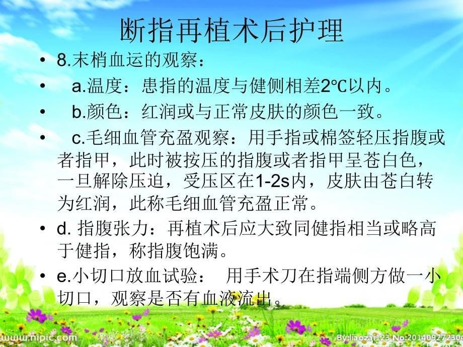 断指再植课件_第5页