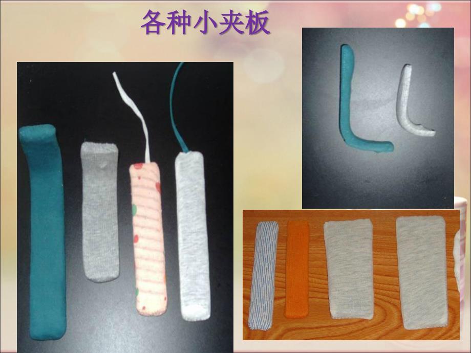 夹板固定术护理 ppt课件_第4页