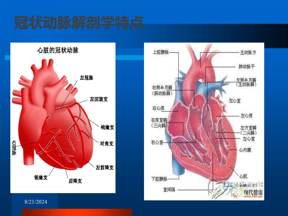 冠脉造影术PPT课件_第3页