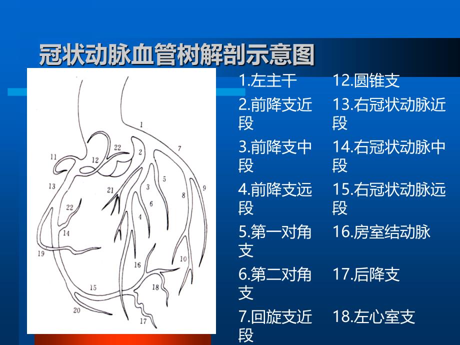 冠脉造影术PPT课件_第4页