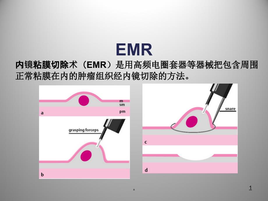 内镜ppt课件.ppt_第1页