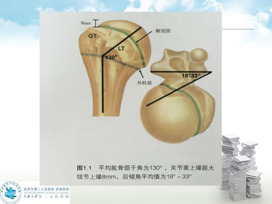 肱骨近端骨折的解剖和分型课件_第5页