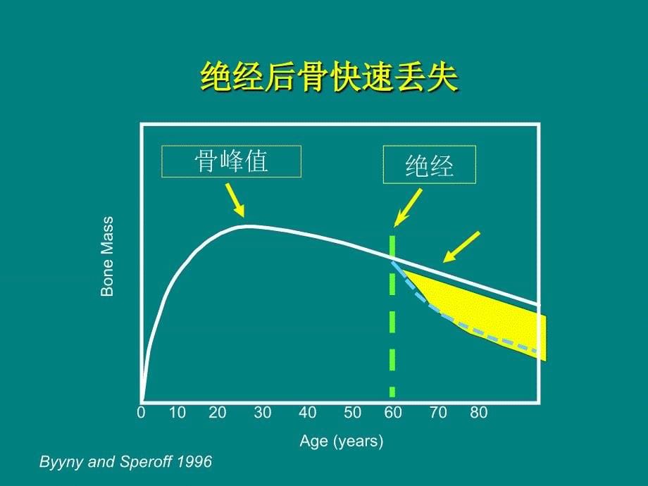 绝经骨松(院讲座)_第5页