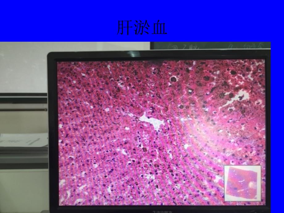 病理学实验切片考试图片58263.ppt_第4页