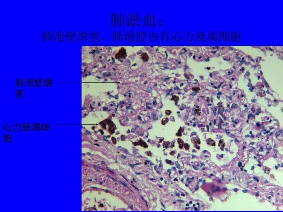 病理学实验切片考试图片58263.ppt_第5页