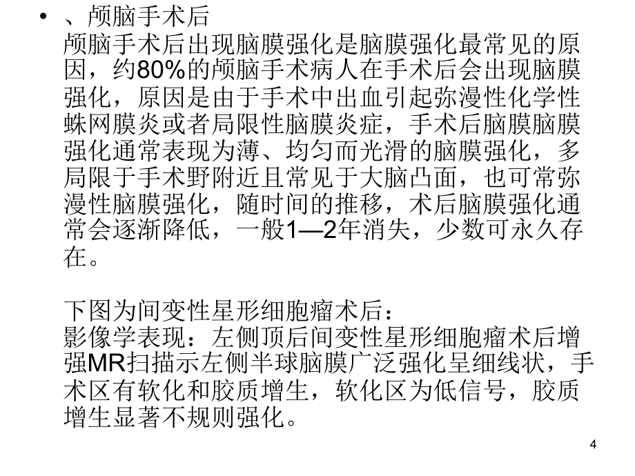 颅脑病变影像诊断ppt课件_第4页