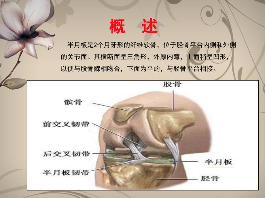 膝关节半月板损伤_第4页