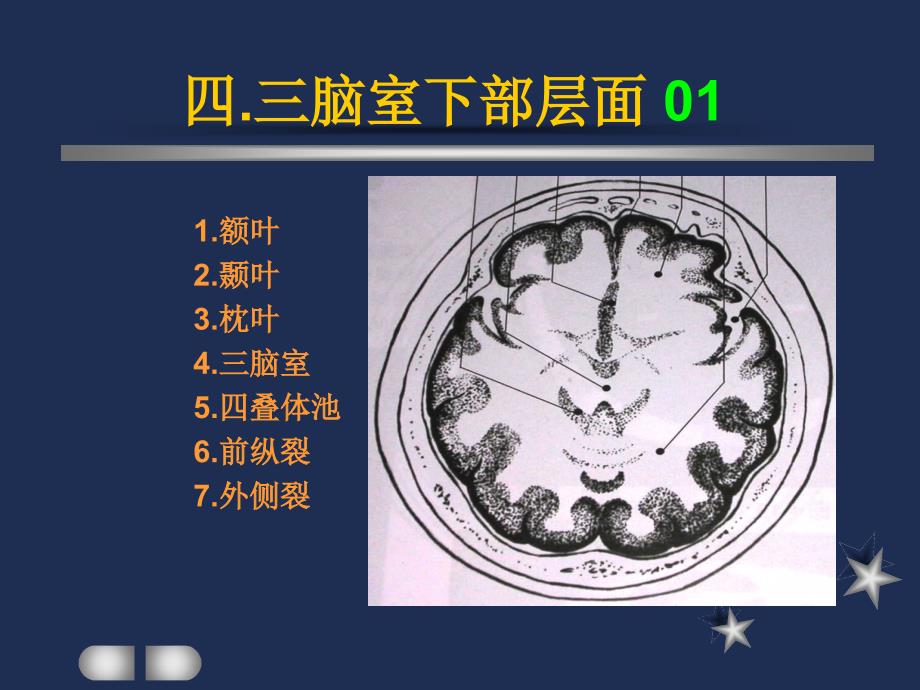 四.三脑室下部层面解剖要点_第1页