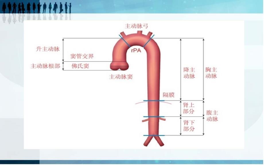 主动脉夹层影像学分析（深度分析）_第3页