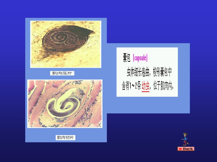 《人体寄生虫学 》教学课件：02_2旋毛虫_第4页