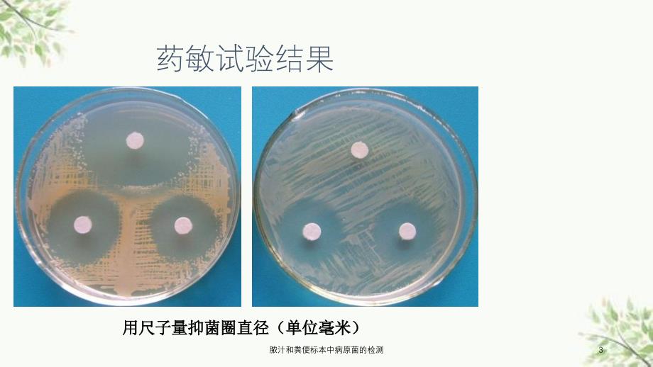 脓汁和粪便标本中病原菌的检测课件_第3页