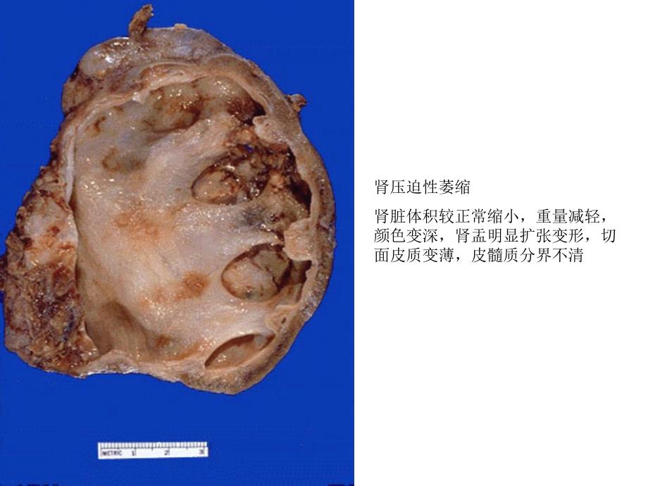 病理实验(图文并茂)X考试图片_第1页