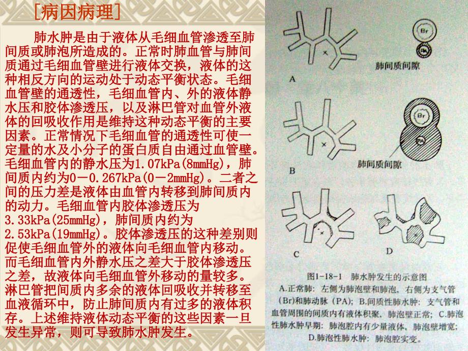 最新肺血液循环障碍性疾病课件PPT文档_第2页