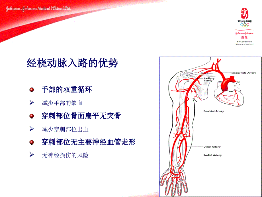 经桡动脉PCI指引导管的选择-阜外医院-姚民-1课件_第3页