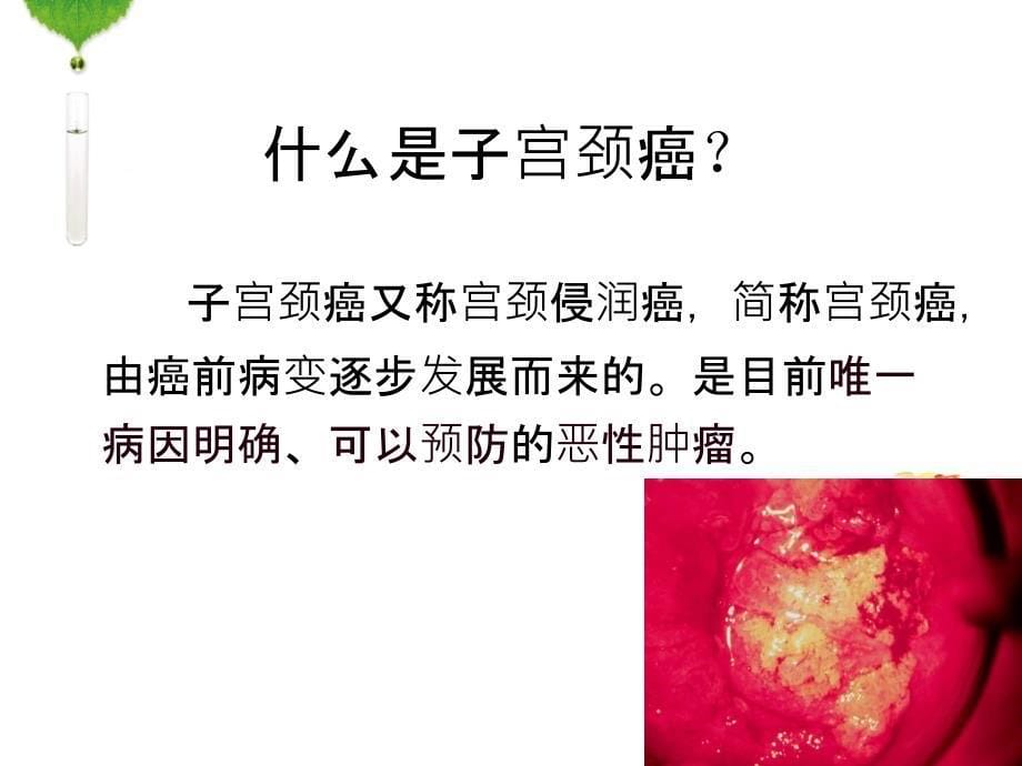 HPV感染与宫颈癌.ppt_第5页