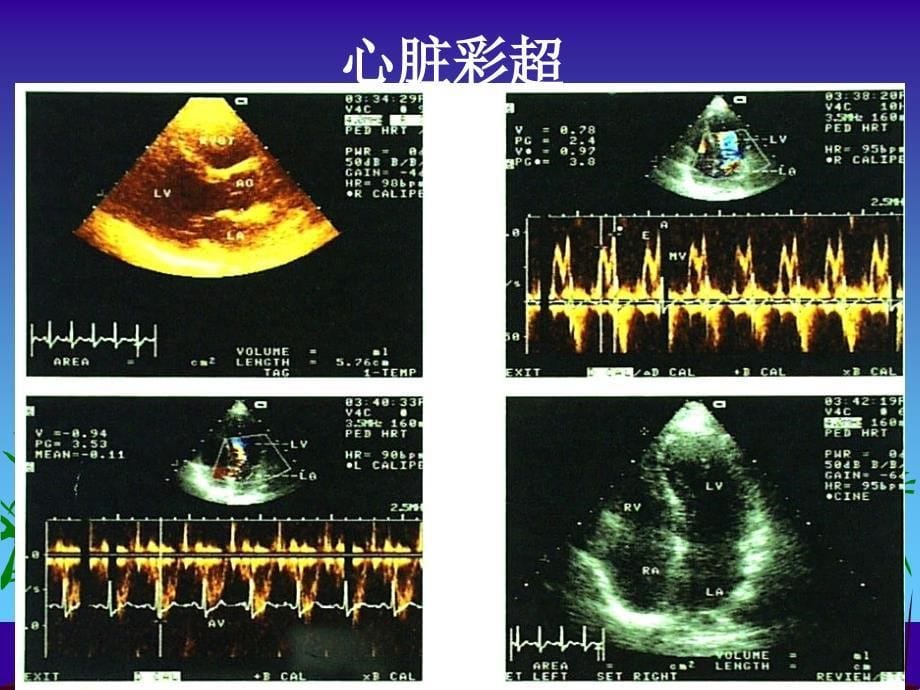 《放射诊断学总论》PPT课件.ppt_第5页