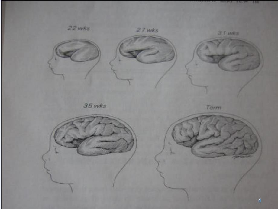 MR在儿童脑白质发育中的应用ppt课件_第4页