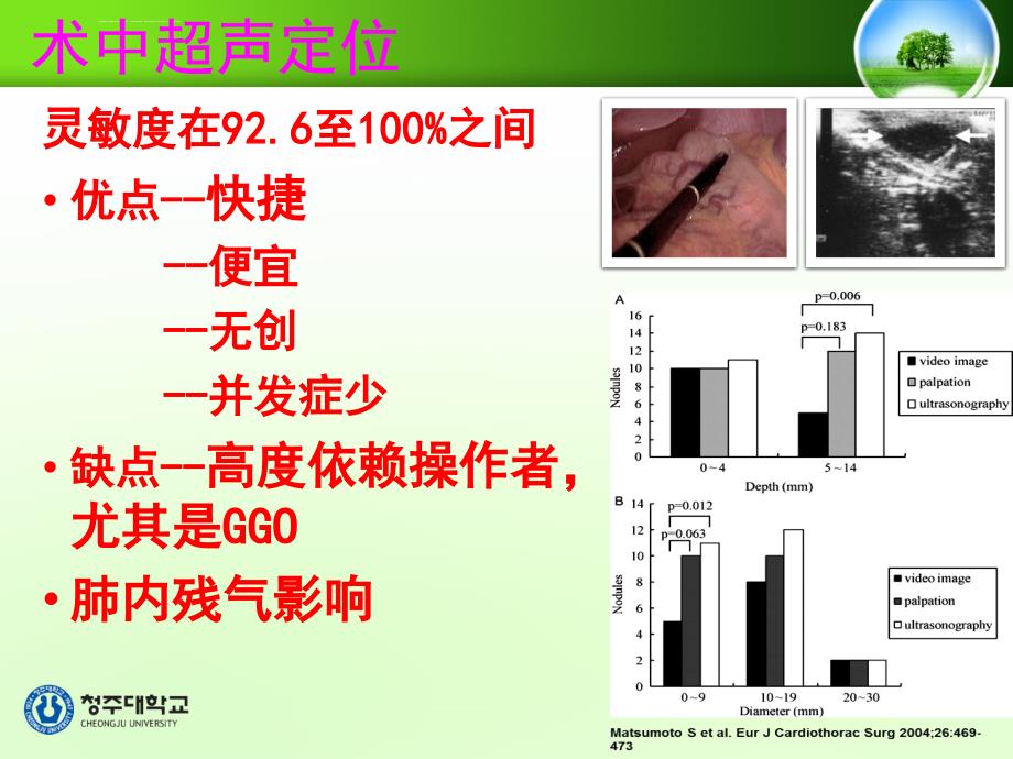 弹簧卷定位在肺部小结节病变中的应用_第4页