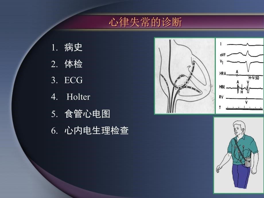 王梦洪心律失常_第5页