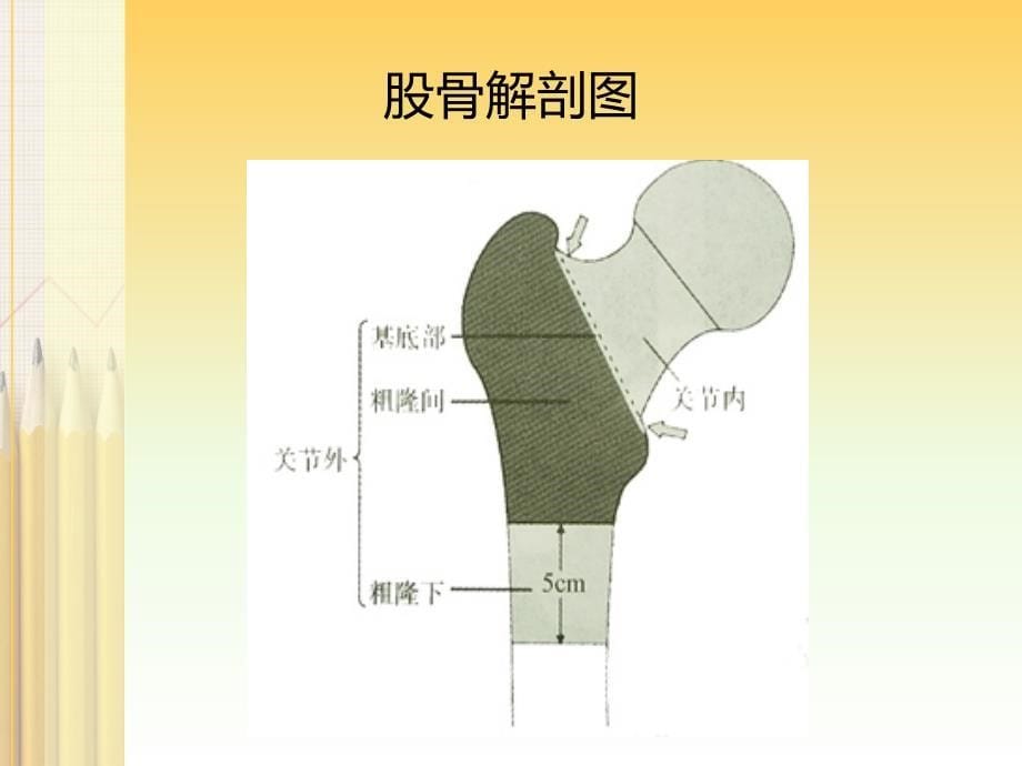 股骨转子间骨折护理_第5页