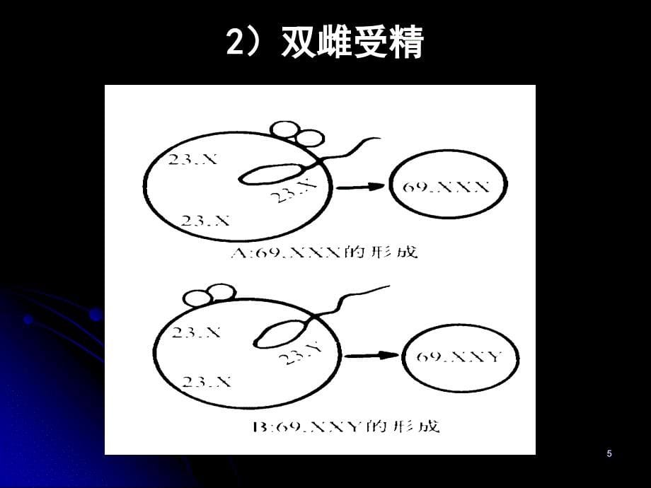 第二节染色体畸变_第5页