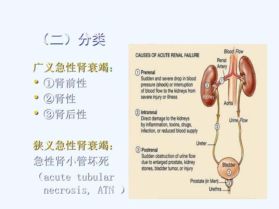 急性肾衰竭医学ppt课件_第5页