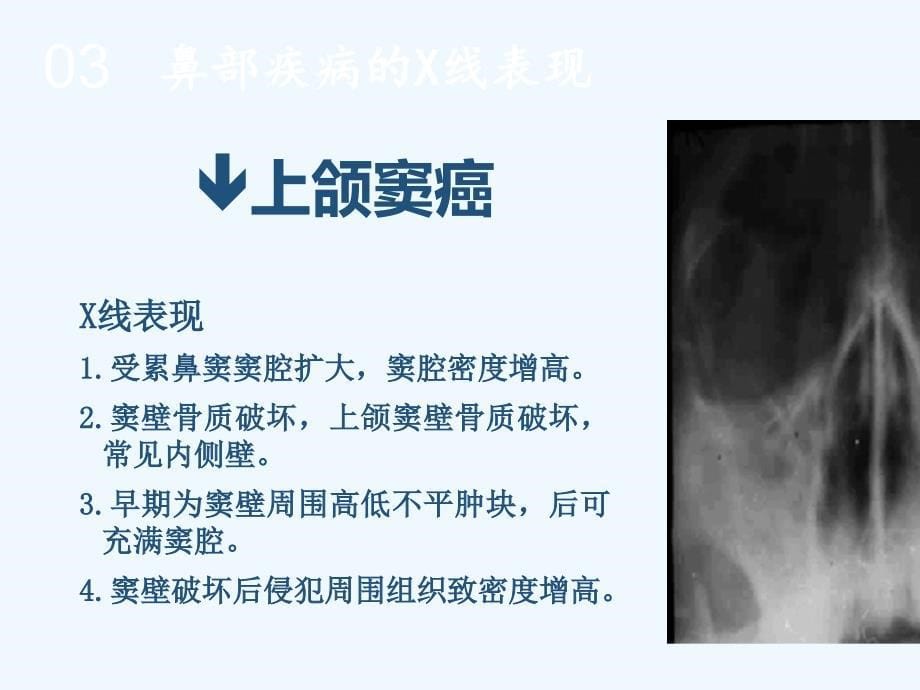 X线检查与诊断技术第四篇胸部一课件_第5页