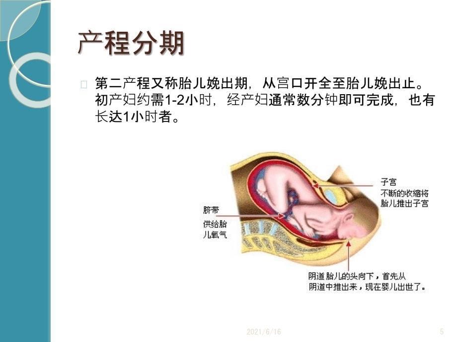 导乐分娩课件_第5页