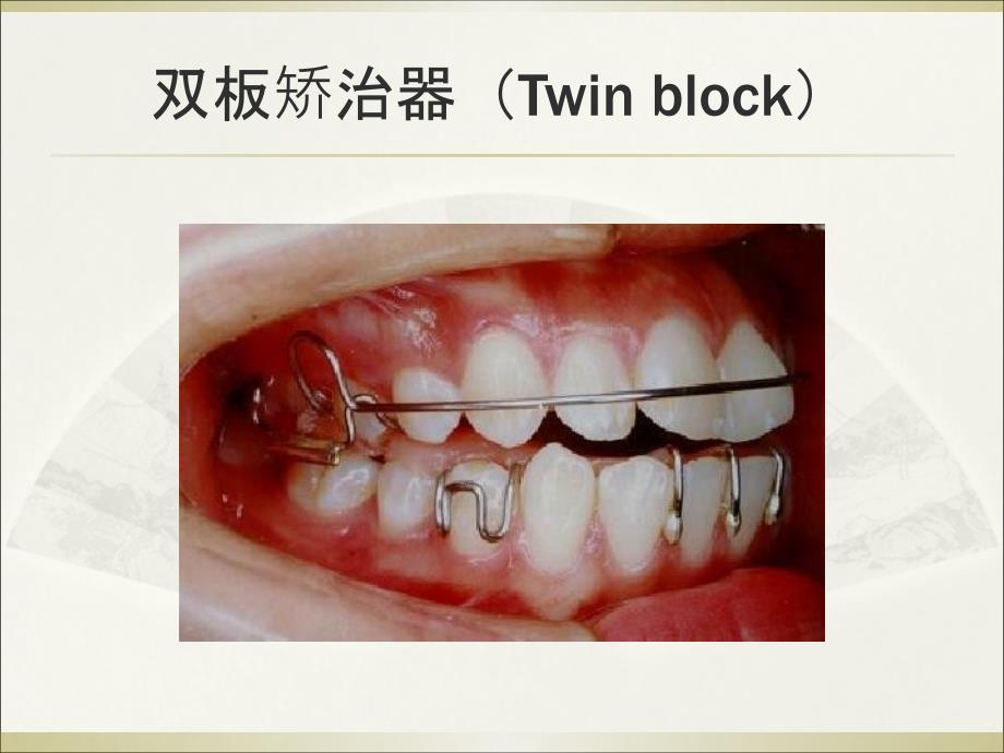 邻间钩与箭头卡PPT课件_第2页