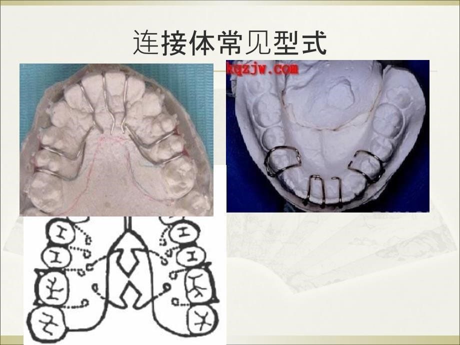 邻间钩与箭头卡PPT课件_第5页