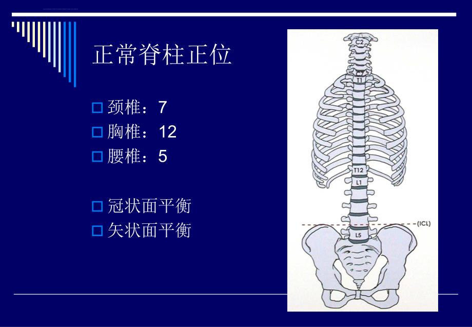 脊柱侧弯基础知识ppt课件_第3页