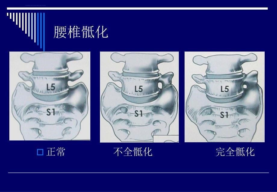 脊柱侧弯基础知识ppt课件_第5页