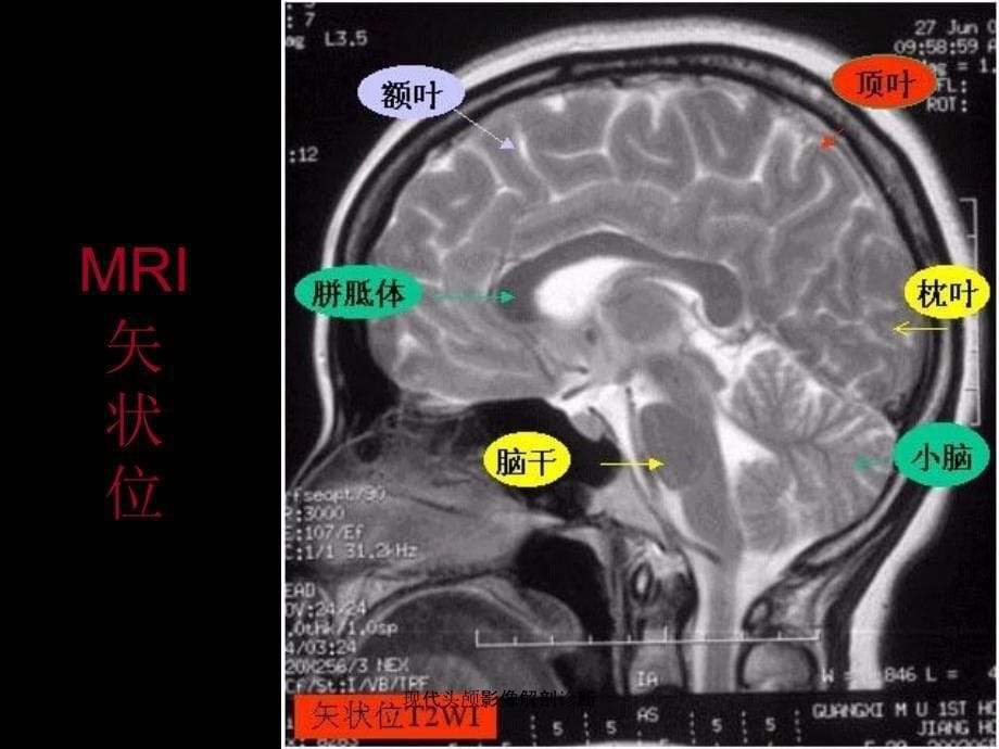 现代头颅影像解剖诊断课件_第5页