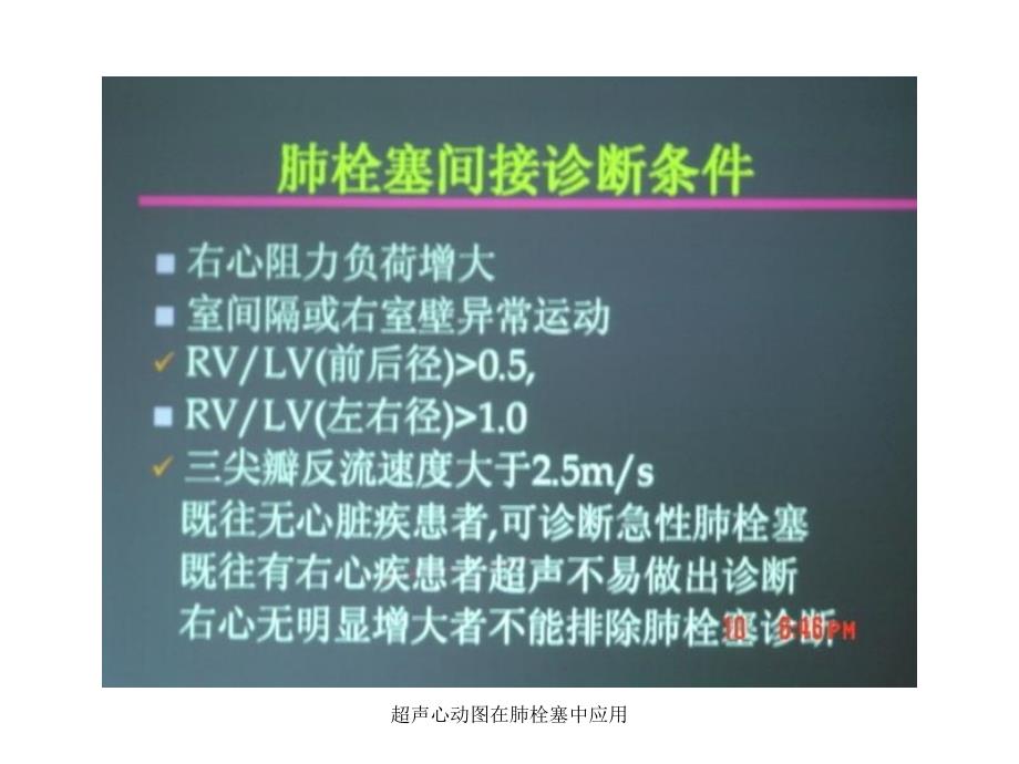 超声心动图在肺栓塞中应用课件_第4页