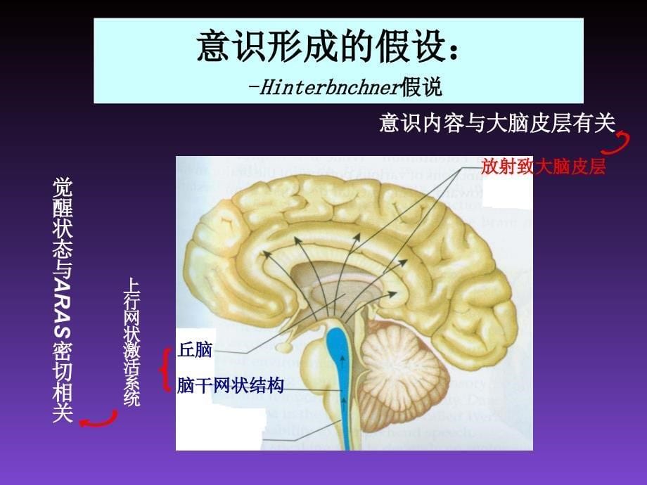 危重病人的意识评估 课件_第5页