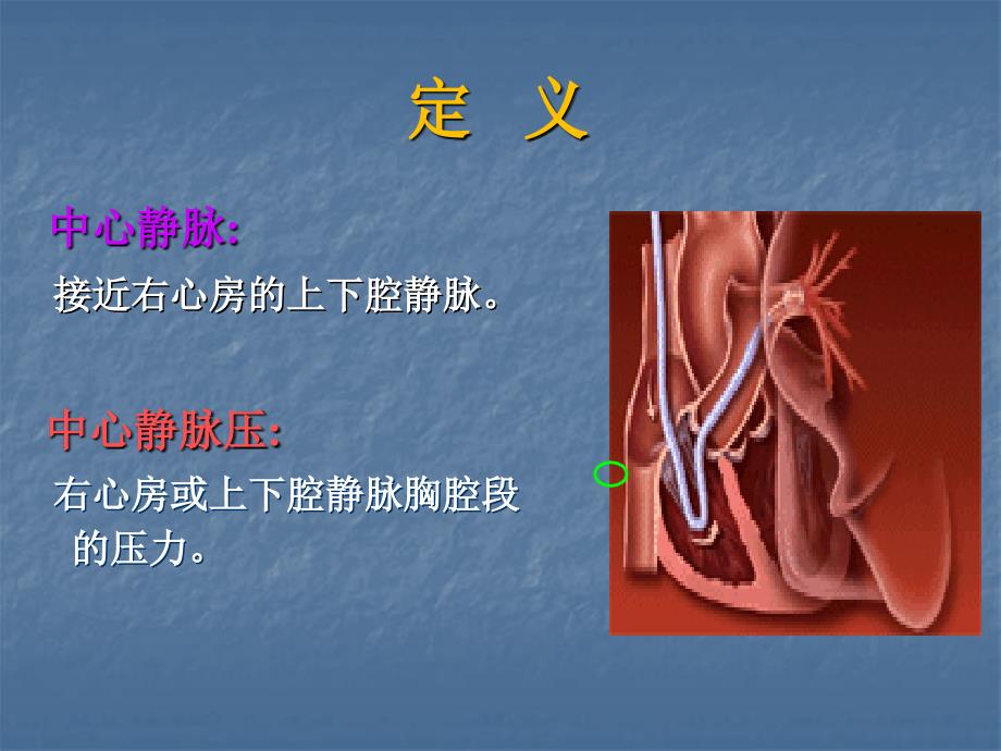 中心静脉压的测量和中心静脉的护理_第4页