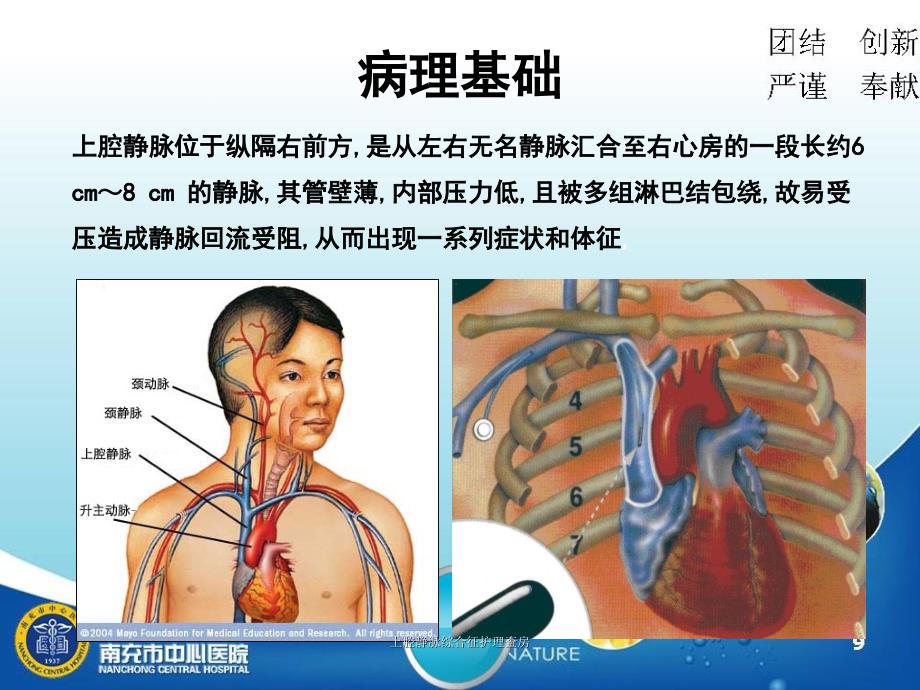 上腔静脉综合征护理查房_第3页