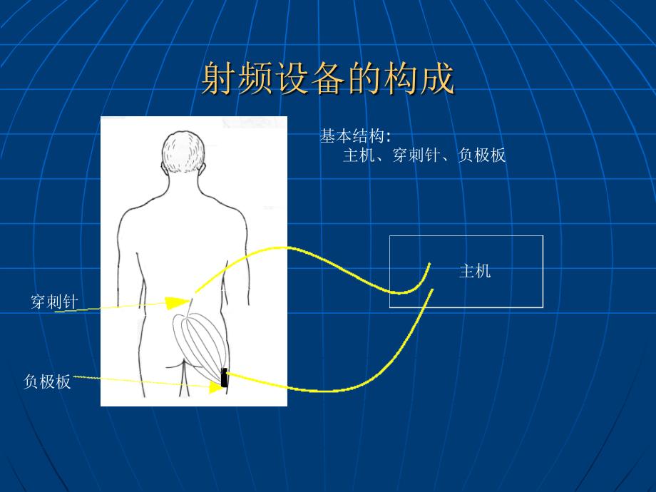 射频热凝术治疗颈腰椎间盘突出症_第3页