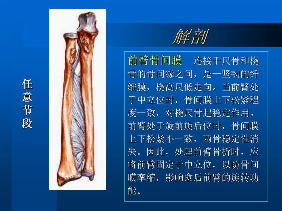 桡尺骨干双骨折.ppt_第5页