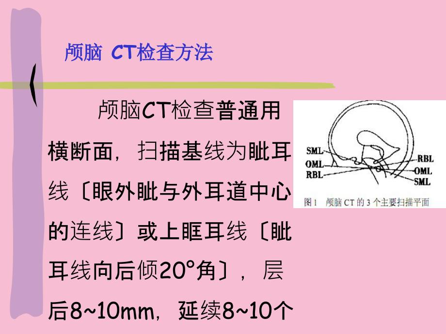 颅脑断面解剖ppt课件_第3页