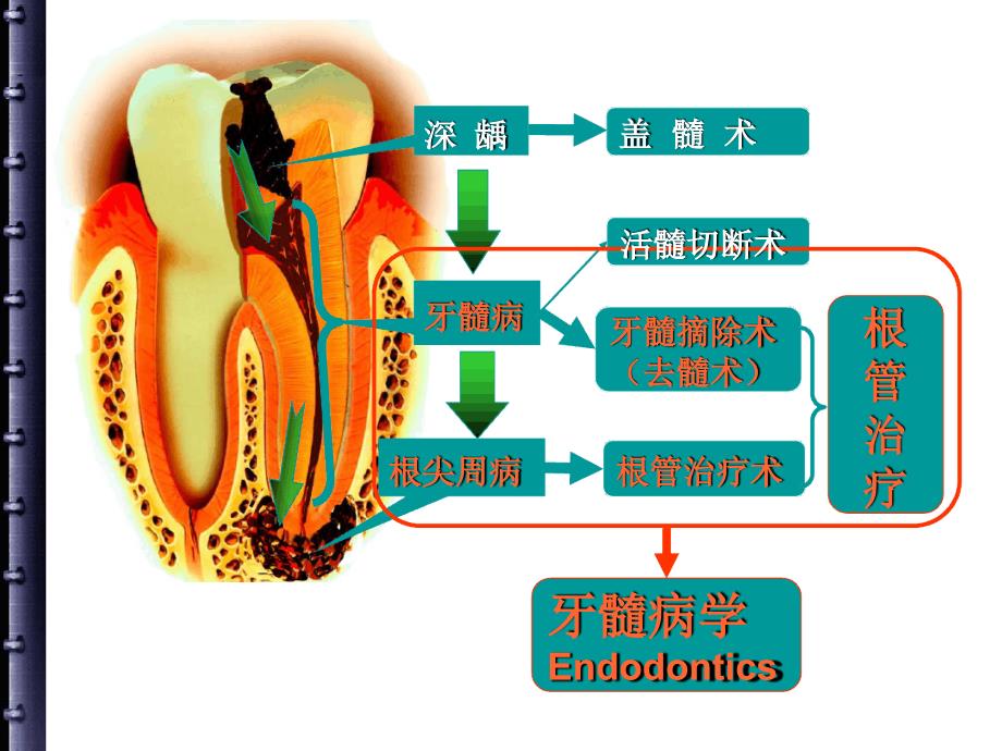 根管治疗的步骤方法器械课件_第2页