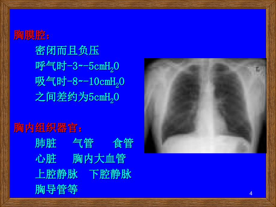 胸部损伤ppt课件_第4页