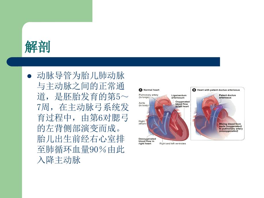 关注早产儿动脉导管未闭_第2页