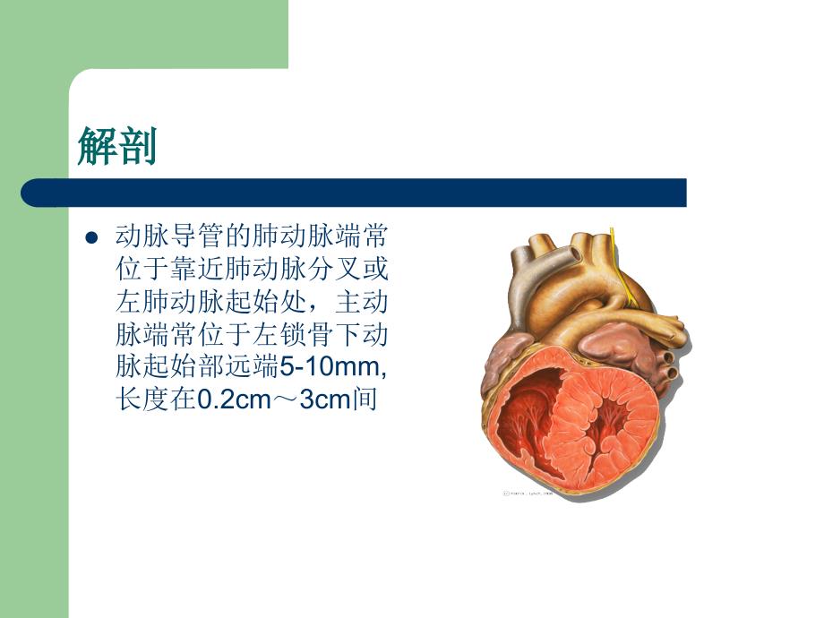 关注早产儿动脉导管未闭_第3页