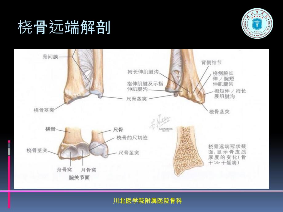 掌背侧钢板治疗桡骨远端骨折课件_第3页