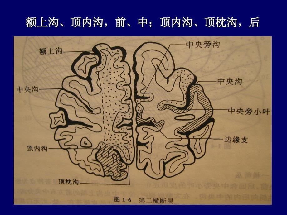 脑血管影像解剖_第5页