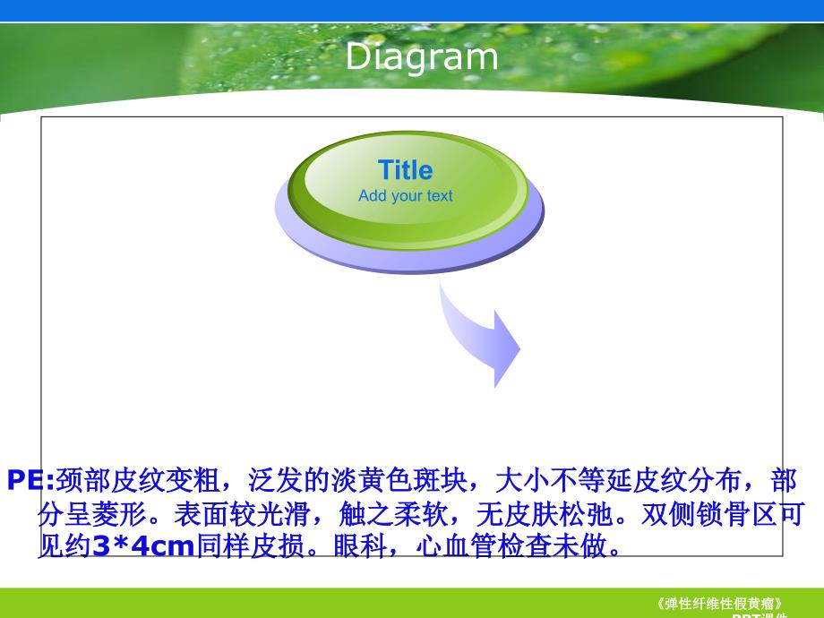 弹性纤维性假黄瘤课件_第4页