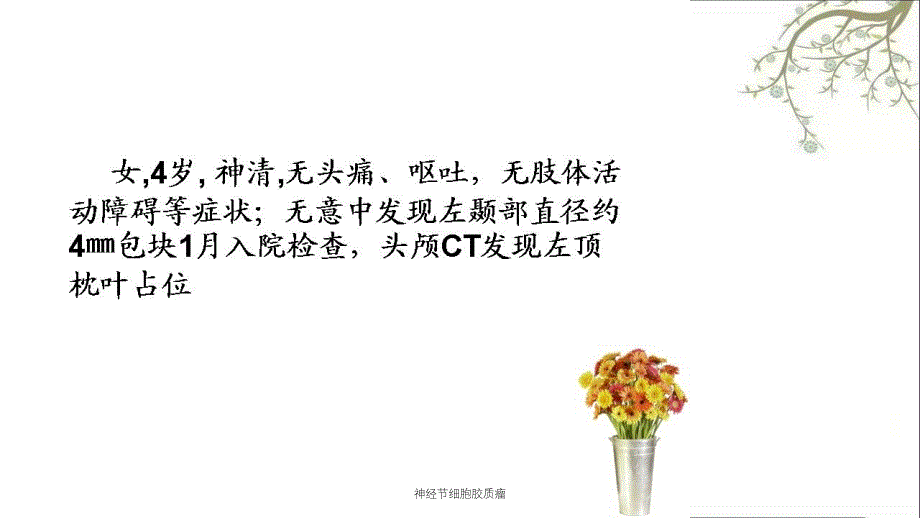 神经节细胞胶质瘤课件_第1页