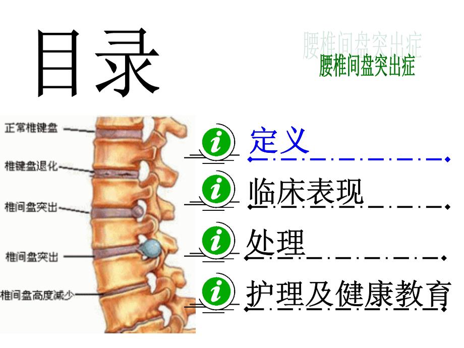 腰椎间盘突出症护理ppt课件_第2页